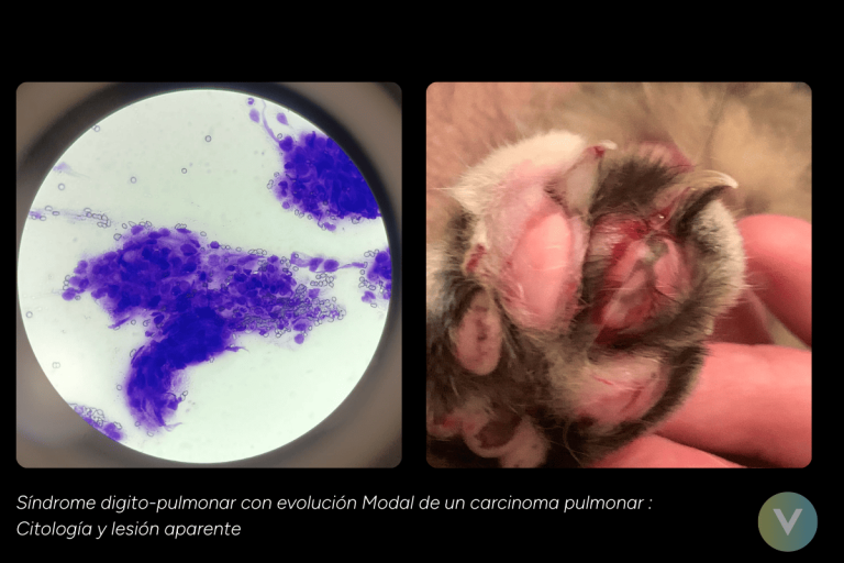 1.5.3 oncologia