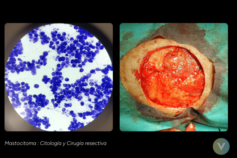 1.5.4 oncologia